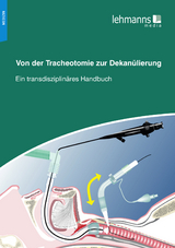Von der Tracheotomie zur Dekan&uuml;lierung