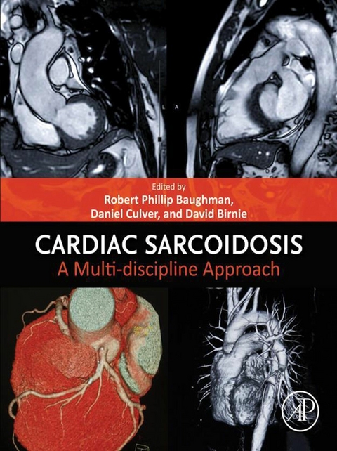Cardiac Sarcoidosis - 