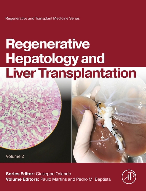 Regenerative Hepatology and Liver Transplantation - 