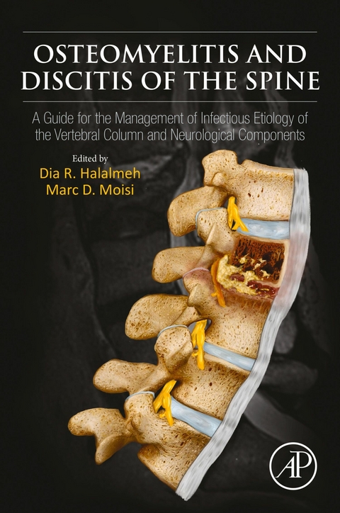 Osteomyelitis and Discitis of the Spine - 