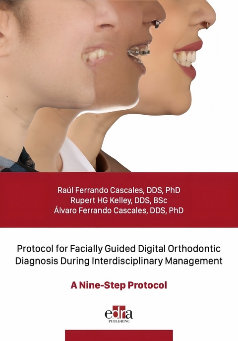 Protocol for Facially Guided Digital Orthodontic Diagnosis During Interdisciplinary Management - A Nine-Step Protocol - Ra&uacute;l Ferrando Cascales, Rupert HG Kelley, &Aacute;lvaro Ferrando Cascales
