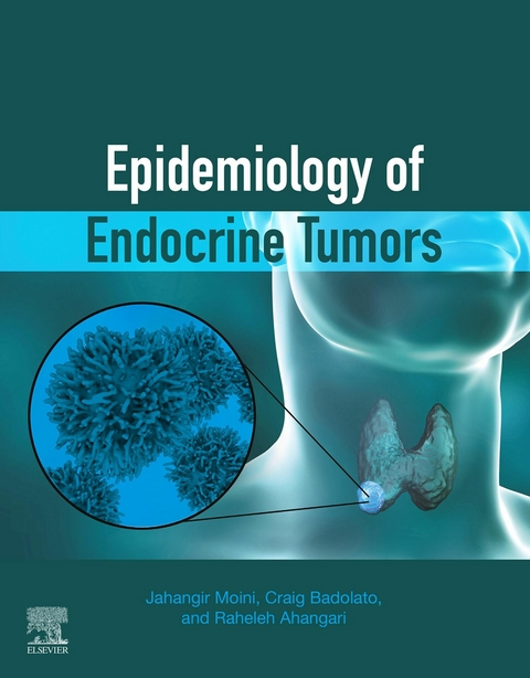 Epidemiology of Endocrine Tumors -  Raheleh Ahangari,  Craig Badolato,  Jahangir Moini
