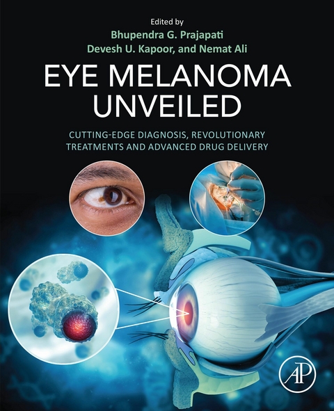 Eye Melanoma Unveiled - 