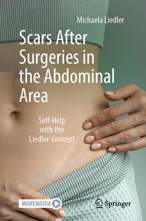 Scars After Surgeries in the Abdominal Area -  Michaela Liedler