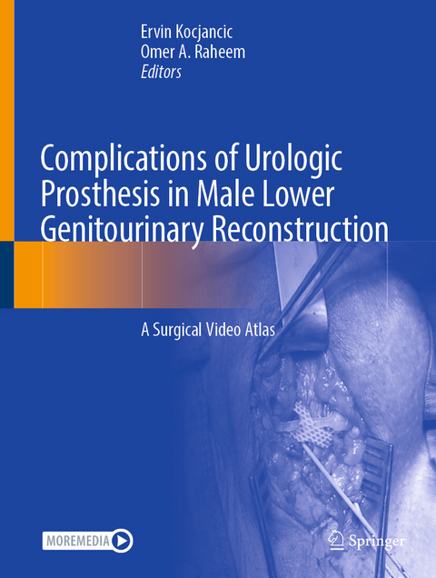 Complications of Urologic Prosthesis in Male Lower Genitourinary Reconstruction - 