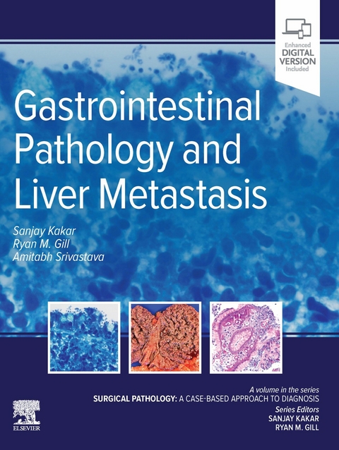 Gastrointestinal Pathology and Liver Metastasis: A Case-Based Approach to Diagnosis - E-Book -  Ryan M. Gill,  Sanjay Kakar,  Amitabh Srivastava