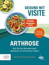 Gesund mit Visite &ndash; Arthrose -  Visite