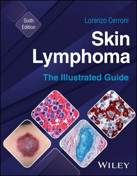 Skin Lymphoma - Lorenzo Cerroni