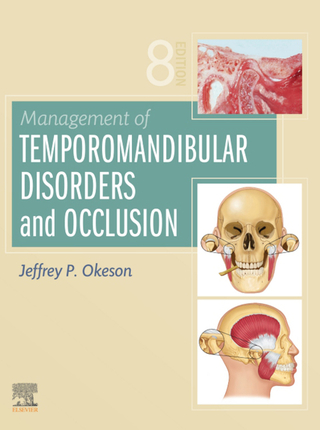 Management of Temporomandibular Disorders and Occlusion
