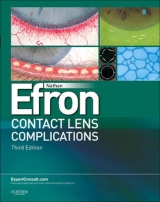 Contact Lens Complications - Efron, Nathan