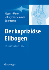 Der kaprizi&ouml;se Ellbogen - 