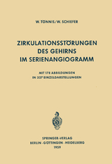 Zirkulationsst&ouml;rungen des Gehirns im Serienangiogramm - W. T&ouml;nnis, W. Schiefer