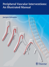 Peripheral Vascular Interventions: An Illustrated Manual - J&uuml;rgen Schr&ouml;der