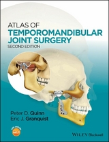 Atlas of Temporomandibular Joint Surgery - 