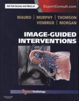 Image-Guided Interventions - Mauro, Matthew A.; Murphy, Kieran P. J.; Thomson, Kenneth R.; Venbrux, Anthony C.