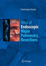 Atlas of endoscopic major pulmonary resections - Dominique Gossot