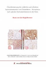 Charakterisierung des zeitlichen und zellul&auml;ren Expressionsmusters von Chemokinen /-Rezeptoren nach spinalen Kontusionsl&auml;sionen in der Ratte - Beata von der Ropp-Brenner