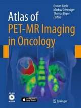 Atlas of PET/MR Imaging in Oncology - 