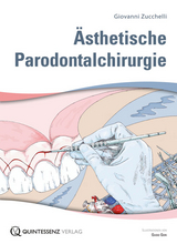 &Auml;sthetische Parodontalchirurgie - Giovanni Zucchelli