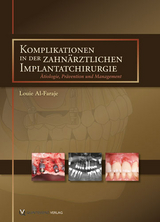 Komplikationen in der zahn&auml;rztlichen Implantatchirurgie - Louie Al-Faraje