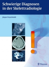 Schwierige Diagnosen in der Skelettradiologie - J&uuml;rgen Freyschmidt