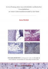 in-vivo-Testung eines neu entwickelten synthetischen Gewebeklebers an einem Leberresektionsmodell an der Ratte - Anna Woitok