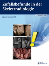 Zufallsbefunde in der Skelettradiologie -  J&uuml;rgen Freyschmidt