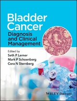 Bladder Cancer - 