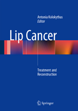 Lip Cancer - 