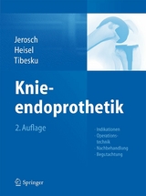 Knieendoprothetik - J&ouml;rg Jerosch, J&uuml;rgen Heisel, Carsten O. Tibesku