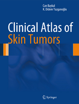 Clinical Atlas of Skin Tumors - Can Baykal, K. Didem Yazganoğlu