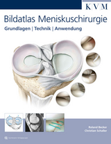 Bildatlas Meniskuschirurgie - Roland Becker, Christian Schaller