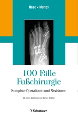 100 F&auml;lle Fu&szlig;chirurgie - 