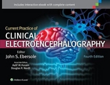 Current Practice of Clinical Electroencephalography - Ebersole, Dr. John S.; Husain, Dr. Aatif M.; Nordli, Dr. Douglas R., Jr.