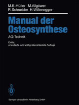 Manual der OSTEOSYNTHESE - Müller, Maurice E.; Allgöwer, Martin; Schneider, Robert; Willenegger, Hans