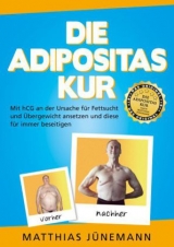 Die Adipositas-Kur - Matthias J&uuml;nemann