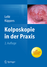 Kolposkopie in der Praxis - Ralph J. Lell&eacute;, Volkmar K&uuml;ppers