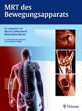 MRT des Bewegungsapparats - Martin Vahlensieck, Maximilian Reiser