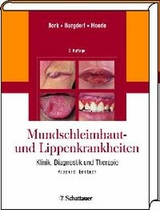 Mundschleimhaut und Lippenkrankheiten -  Konrad Bork,  Walter Burgdorf,  Nikolaus Hoede