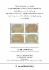 Mittel- & langfristige Effekte von kombinierter multimodaler Fr&uuml;hstimulation und aktivierender Umgebung auf neurofunktionales Outcome und Neuroplastizit&auml;t nach experimenteller Sch&auml;del-Hirn-Verletzung an der Ratte - Katrin Wontorra