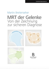 MRT der Gelenke - 