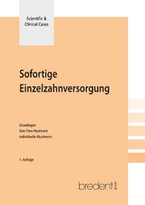 Sofortige Einzelzahnversorgung