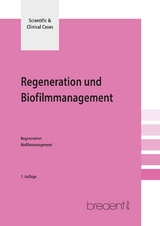 Regeneration und Biofilmmanagement
