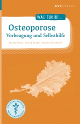 Osteoporose - Michael Elies, Eckard Kr&uuml;ger, Annette Kerckhoff