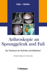 Arthroskopie an Sprunggelenk und Fu&szlig; - 