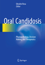 Oral Candidosis - 