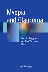 Myopia and Glaucoma - 