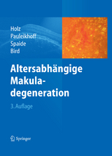 Altersabh&auml;ngige Makuladegeneration - 