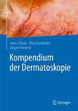Kompendium der Dermatoskopie - Hans Schulz, Max Hundeiker, J&uuml;rgen Kreusch