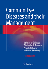 Common Eye Diseases and their Management - Galloway, Nicholas R.; Amoaku, Winfried M. K.; Galloway, Peter H.; Browning, Andrew C
